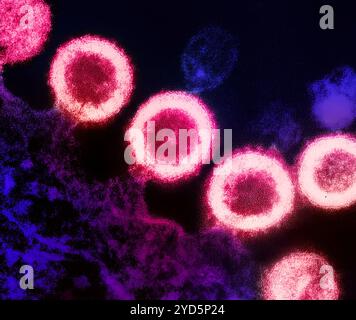 Transmission electron micrograph of HIV-1 virus particles (pink) replicating from the plasma membrane of an infected H9 T cell (purple). Stock Photo