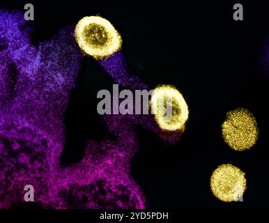 Transmission electron micrograph of HIV-1 virus particles (yellow) replicating from the plasma membrane of an H9 T cell (purple and pink). Stock Photo