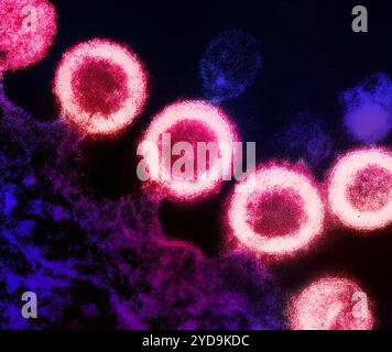 Transmission electron micrograph of HIV-1 virus particles pink replicating from the plasma membrane of an infected H9 T cell purple. HIV-1 Virus 016867 217 Stock Photo