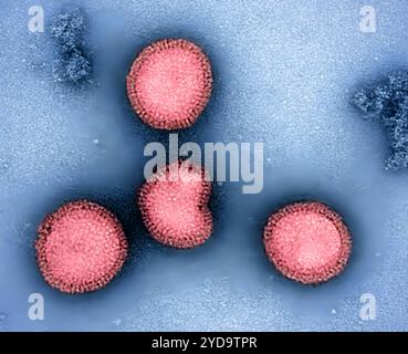 Influenza (flu) is a viral infection that can cause fever, cough, sore ...