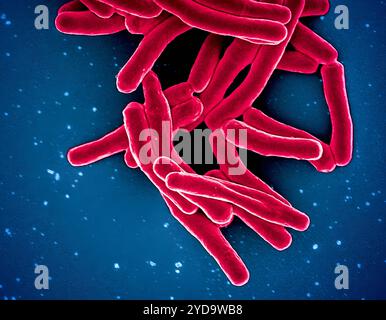 Scanning electron micrograph of Mycobacterium tuberculosis particles colorized red, the bacterium which causes TB. Mycobacterium Tuberculosis Bacteria, the Cause of TB 016867 405 Stock Photo