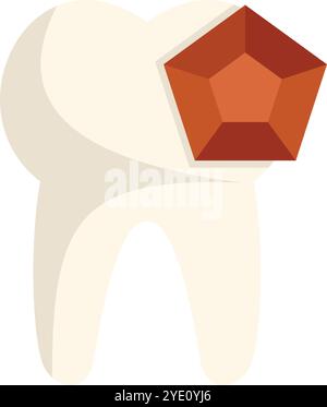 White tooth with a red gem embedded in it, illustrating the concept of dental implants and the use of precious materials in dentistry Stock Vector