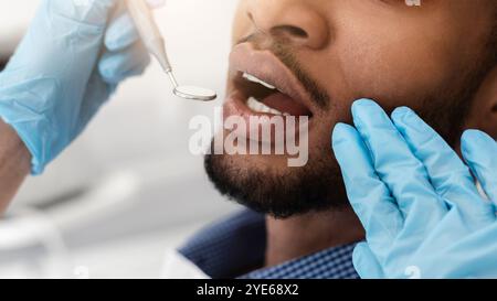 Dentist hands in gloves checking black man mouth Stock Photo