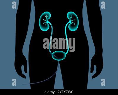 Conceptual illustration of a ureteroscopy procedure. This is a procedure performed to examine or treat problems in the urinary tract such as kidney stones. Stock Photo