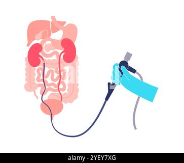 Conceptual illustration of a ureteroscopy procedure. This is a procedure performed to examine or treat problems in the urinary tract such as kidney stones. Stock Photo