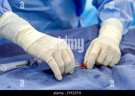 Cardiac surgery at Hotel Dieu de France hospital in Beirut, Lebanon. Cardiology cardiopathy 016757 126 Stock Photo