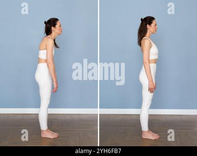How Can I Correct My Slouching to Avoid Kyphosis?