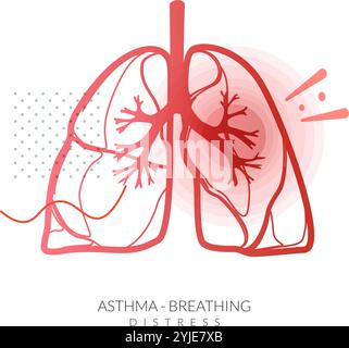 Asthma - Lungs with Breathing Distress - Stock Illustration as EPS 10 File Stock Vector