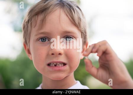 6 years old boy shows the ruptured milk tooth Stock Photo