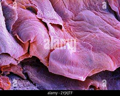 Skin layers. Coloured scanning electron micrograph (SEM) of a freeze ...