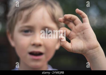 6 years old boy shows the ruptured milk tooth Stock Photo