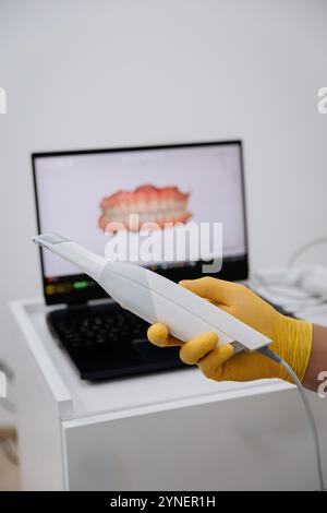 Dentist holding a 3D intraoral scanner with a digital teeth model on a laptop in the background Stock Photo