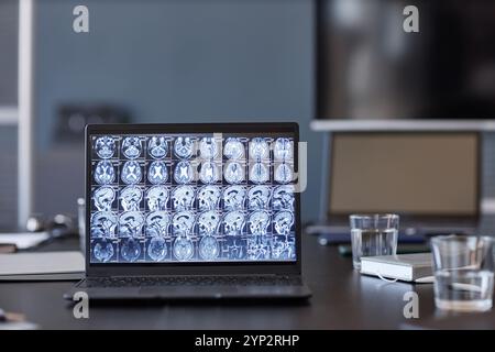 Background image of open laptop showing X ray scan of patients brain on screen on table in neurologists office, copy space Stock Photo