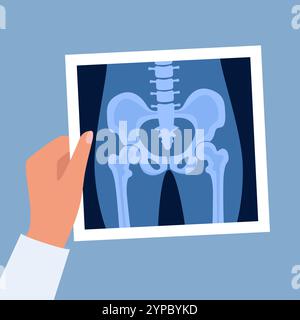 XRay of hip joint pelvis human bones anatomy orthopedic medical diagnostic. Roentgen shot in doctors hand. Vector illustration Stock Vector