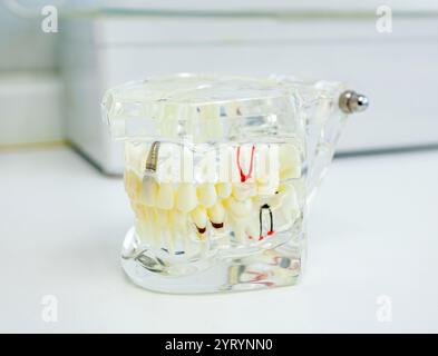 Transparent anatomical model of human jaw with implants showing teeth, gums, and bone structure, perfect for dental education and patient communicatio Stock Photo