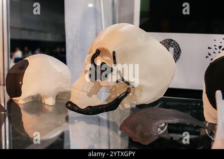Orthopedic implants and individual titanium cranioplasties printed on a 3D printer Stock Photo