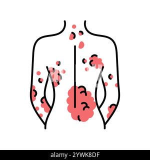Psoriasis color line icon. Autoimmune diseases. Vector isolated element. Editable stroke. Stock Vector
