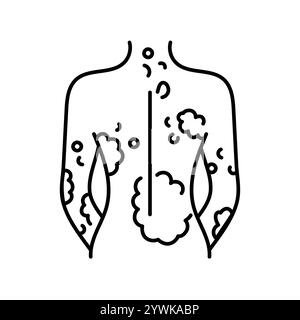 Psoriasis color line icon. Autoimmune diseases. Vector isolated element. Editable stroke. Stock Vector