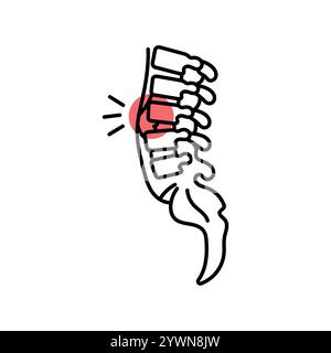 Osteomyelitis color line icon. Diseases of the spine. Vertebrology. Vector isolated element. Editable stroke. Stock Vector