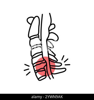 Facet syndrome color line icon. Diseases of the spine. Vertebrology. Vector isolated element. Editable stroke. Stock Vector