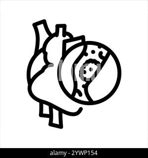 Thrombosis of the heart line black icon. Sign for web page, mobile app, button, logo. Vector isolated button. Editable stroke. Stock Vector