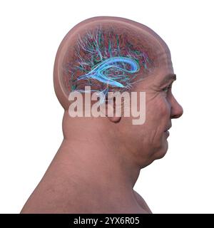 Ventricles and cerebral aqueduct lateral in colors x-ray view 3D ...