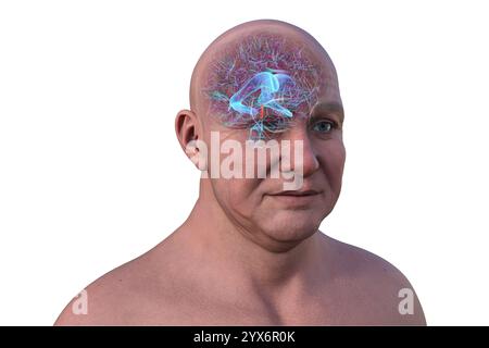 Ventricles and cerebral aqueduct lateral in colors x-ray view 3D ...