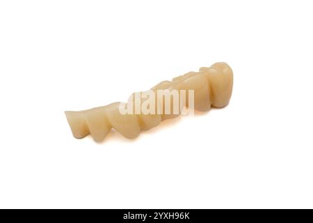 Dental Bridge - Isolated Prosthetic Teeth on White Background for Restorative Dentistry Stock Photo