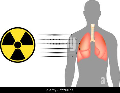 Radiation Exposure on Human Lungs. Human Body Radiation Penetration. Medical Radiation Risk Illustration. Radiation and Health Damage Visualization Stock Vector