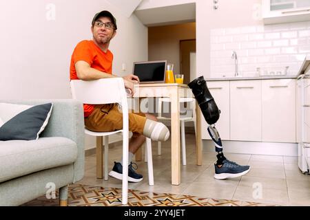 A man with a prosthetic leg sits at a table in a modern kitchen, using a laptop He wears casual attire and enjoys a glass of orange juice The setting Stock Photo