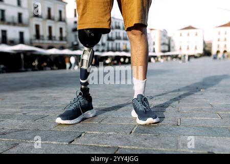 A man wearing shorts showcases an orthopedic prosthetic leg while standing confidently on a city street The image captures a sense of empowerment and Stock Photo