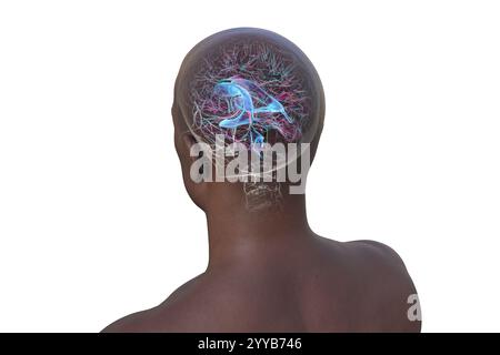 Ventricles and cerebral aqueduct lateral in colors x-ray view 3D ...