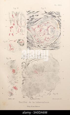 Condition Infectieuses Les, bactéries, et, leur, rôle, dans, l', anatomie, et, l', histologie ...