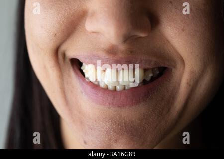 Close-up of a smiling woman showing slightly crooked teeth and gums Stock Photo