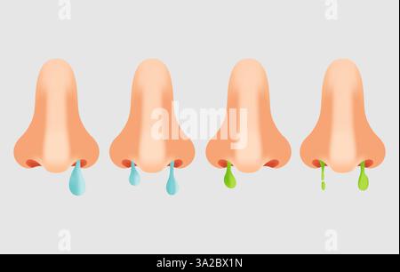 Runny nose, illustration Stock Photo - Alamy