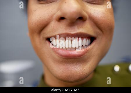 Close-Up of a Woman's Smiling Face Highlighting Clean and White Teeth Stock Photo
