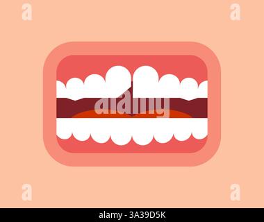 Chipped tooth in mouth. Broken tooth. Stock Vector