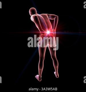 Illustration of a person with lower back pain, emphasising the lumbar region and depicting spinal discomfort, posture and muscular strain. Stock Photo