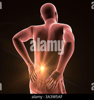 Illustration of a person with lower back pain, emphasising the lumbar region and depicting spinal discomfort, posture and muscular strain. Stock Photo