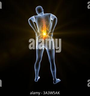 Illustration of a person with lower back pain, emphasising the lumbar region and depicting spinal discomfort, posture and muscular strain. Stock Photo