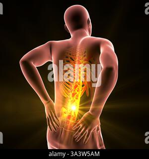 Illustration of a person with lower back pain, emphasising the lumbar region and depicting spinal discomfort, posture and muscular strain. Stock Photo