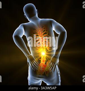 Illustration of a person with lower back pain, emphasising the lumbar region and depicting spinal discomfort, posture and muscular strain. Stock Photo