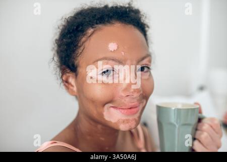 Smiling mixed-race woman with vitiligo relaxing at home, holding a mug. Supports skin positivity, wellbeing, and everyday lifestyle imagery. Stock Photo