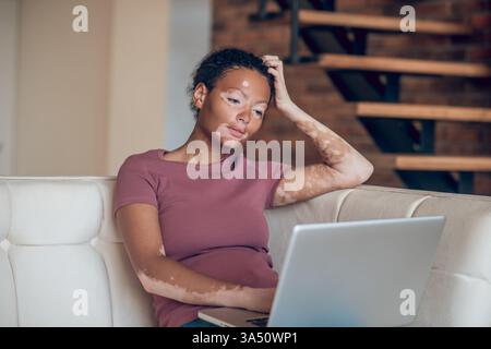 Mixed race woman with vitiligo relaxing at home while using a laptop on the sofa. Great for inclusive beauty, remote work, and everyday lifestyle imagery. Stock Photo