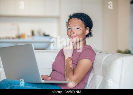 Portrait of a mixed race woman with vitiligo at home, seated with a laptop on the sofa. A candid, real-life representation that promotes skin positivity and wellbeing, perfect for lifestyle and health communications. Stock Photo