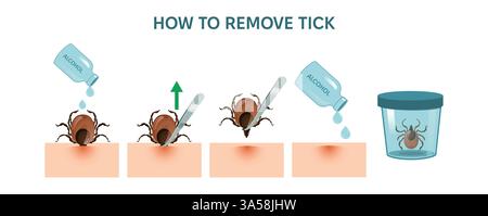 How to remove tick steps Infographic banner. Instruction to prevent Lyme or borreliosis disease because of mite bite. Laboratory testing. Stock Vector