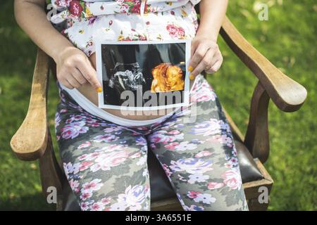 Pregnant women hold picture of womb. Daylight in the garden Stock Photo