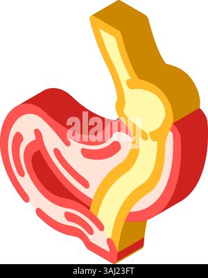 gastric bypass gastroenterologist isometric icon vector illustration ...