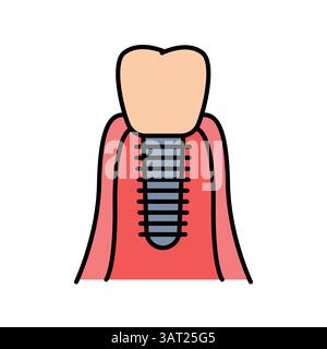 dental implant color flat icon for digital and print projects.  Minimal clean icons for apps and websites. Modern simple icons for UI UX and branding Stock Vector