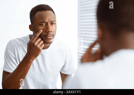 Worried Black Guy Touching Acne On Face Standing In Bathroom Stock Photo